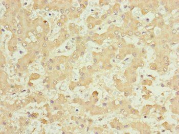 NUF2 Antibody