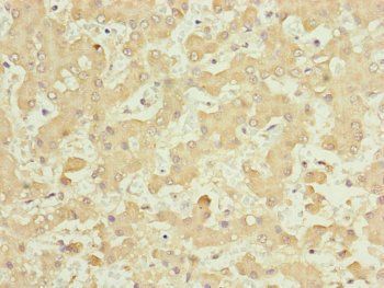 NUF2 antibody