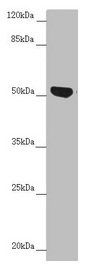 NUF2 antibody