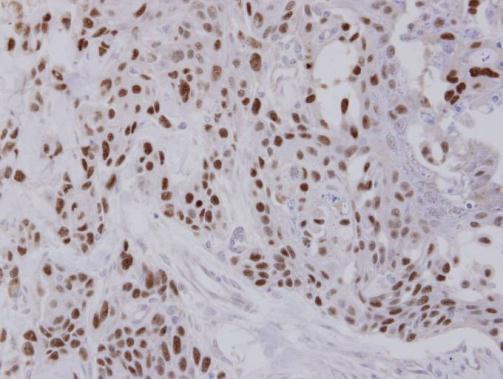 NULP1 antibody