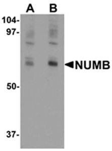 NUMB Rabbit Polyclonal Antibody
