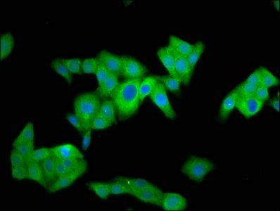 NUMBL Antibody