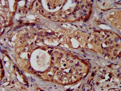 NUMBL Antibody