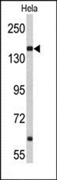 NUP153 antibody