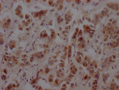 NUP153 Recombinant Monoclonal Antibody