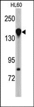 NUP155 antibody