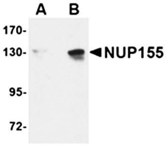 NUP155 Antibody