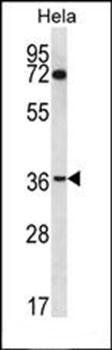 NUP35 antibody