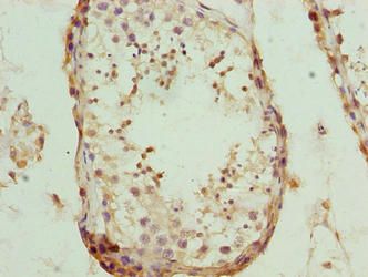 NUP43 Antibody