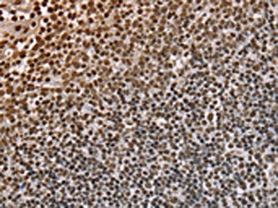 NUP50 Antibody