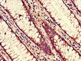 NUP85 Antibody
