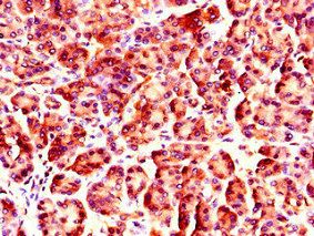 NUP85 Antibody