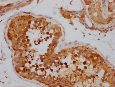 NUP98 Recombinant Monoclonal Antibody