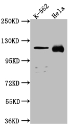 NUP98 Recombinant Monoclonal Antibody