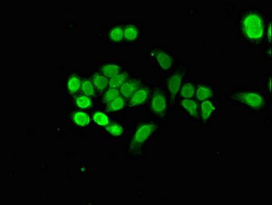 NUPR1 Antibody