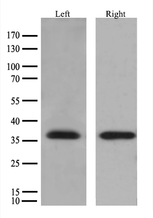 CTAG1B Antibody
