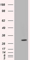 CTAG1B Antibody