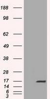 CTAG1B Antibody
