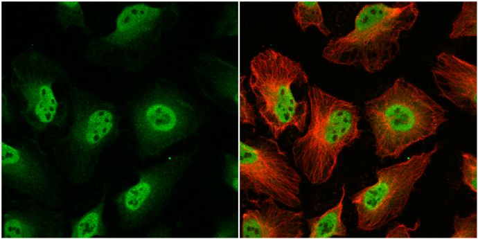 O-GlcNAc transferase antibody