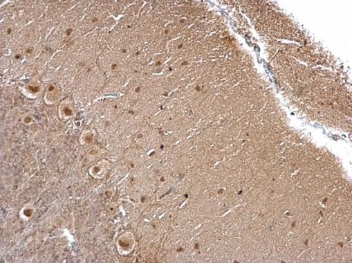 O-GlcNAc transferase antibody