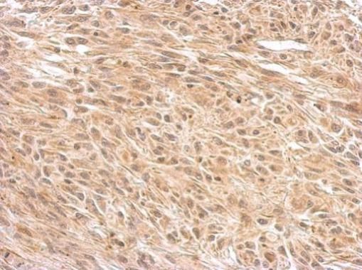 O-GlcNAc transferase antibody [N1N2], N-term