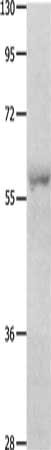 OASL Antibody