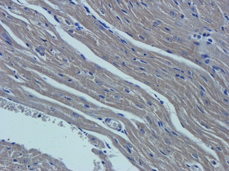 OAT3 antibody