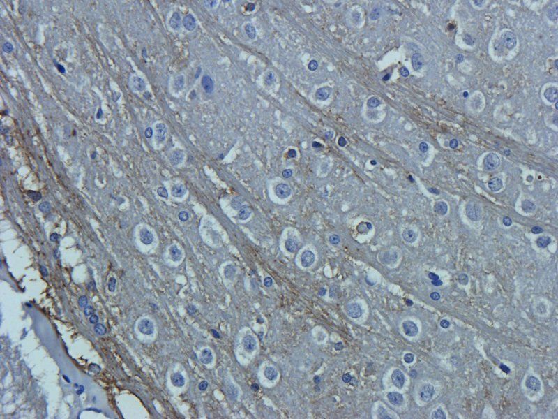 OAT3 antibody