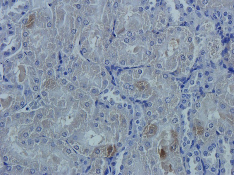 OAT3 antibody