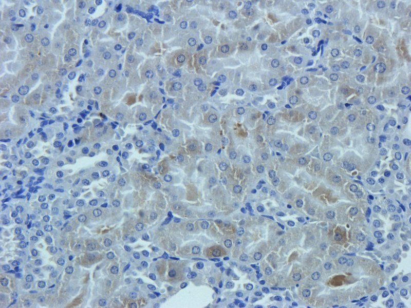 OAT3 antibody