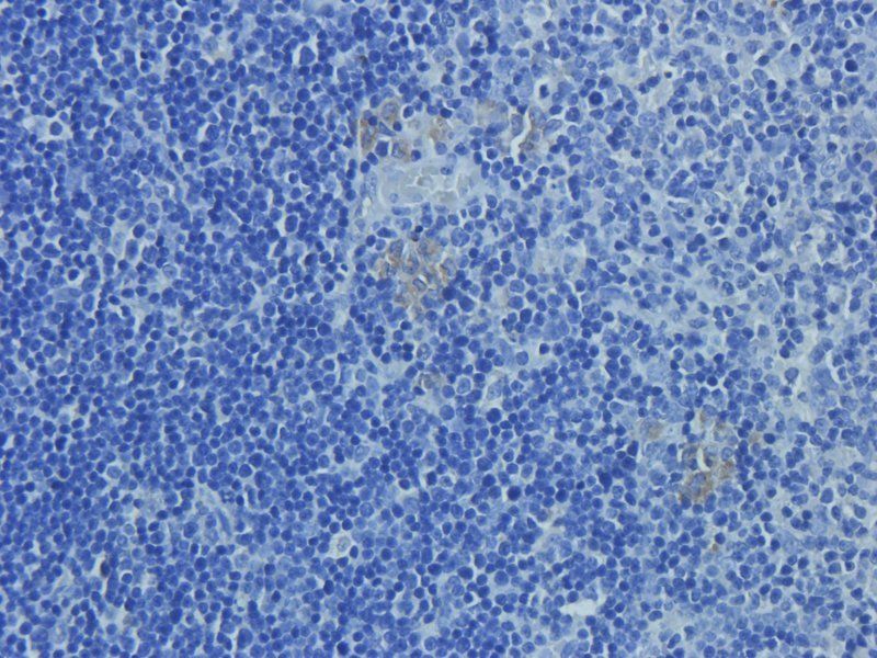 OAT3 antibody