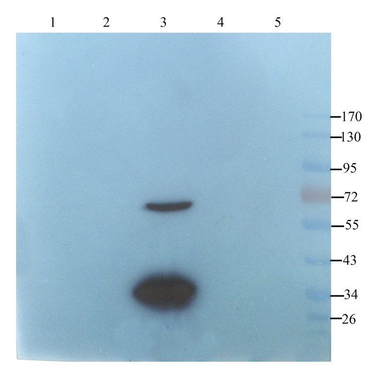 OAT3 antibody