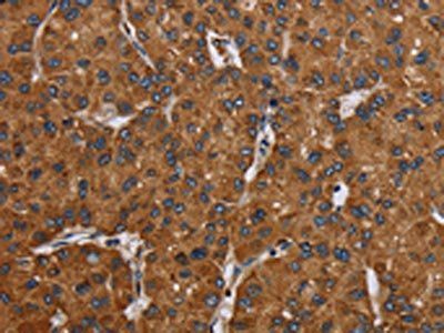 OCC1 Antibody