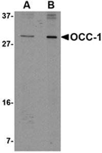 OCC Antibody