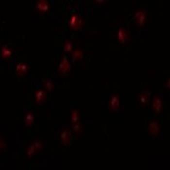 OCIAD2 Antibody