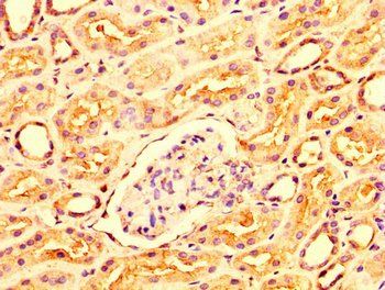 OCRL Antibody