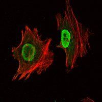 04-Oct Antibody