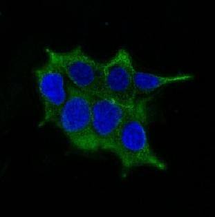 Ornithine Decarboxylase-1 (ODC-1) Antibody