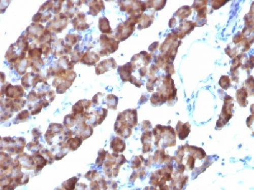 Ornithine Decarboxylase-1 (ODC-1) Antibody