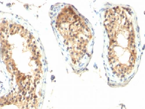 Ornithine Decarboxylase-1 (ODC-1) Antibody