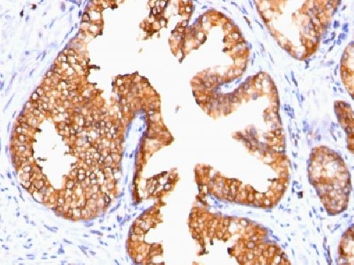 Ornithine Decarboxylase-1 (ODC-1) Antibody