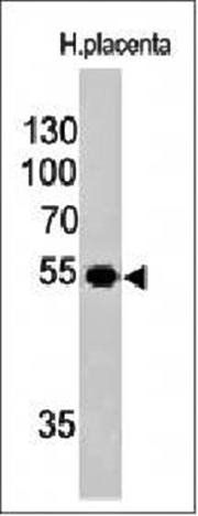 Ornithine Decarboxylase-1 (ODC-1) Antibody