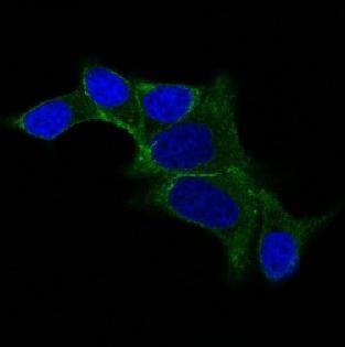 ODC1 antibody