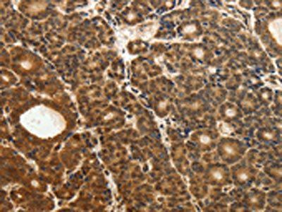 ODC1 antibody