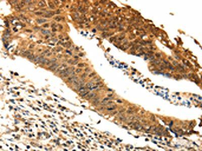 ODC1 Antibody