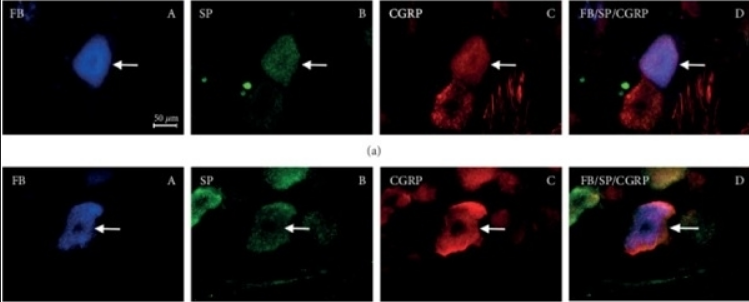 CGRP antibody