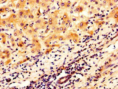 OGN Antibody