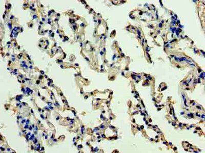 OGN Antibody