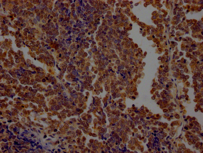 OGT Recombinant Monoclonal Antibody