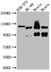 OGT Recombinant Monoclonal Antibody